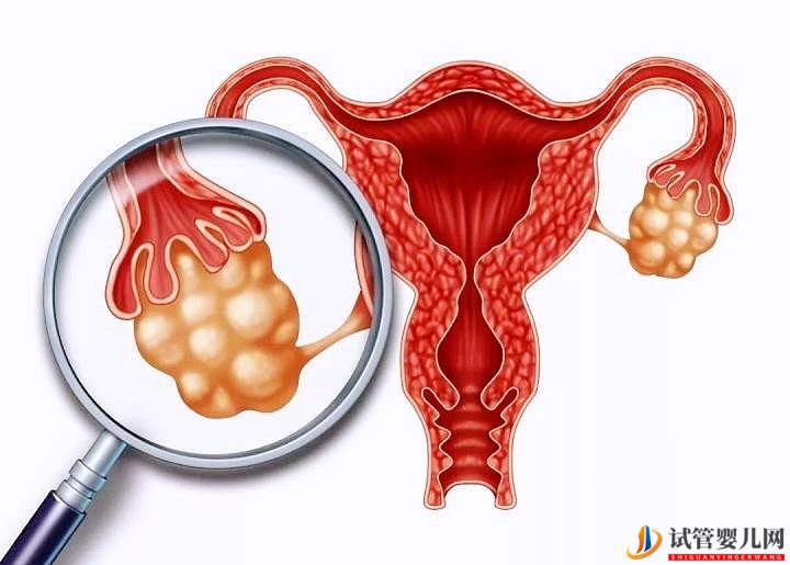 试管促排取不到卵子是怎么回事?试管婴儿促排卵的相关科普(图1) 试管促排取不到卵子是怎么回事?试管婴儿促排卵的相关科普(图1)