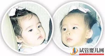 原来这些漂亮明星宝宝都是试管婴儿!盘点那些做试管(图7) 原来这些漂亮明星宝宝都是试管婴儿!盘点那些做试管(图7)
