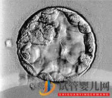 美国试管婴儿_这样的囊胚才是极好的(图18) 美国试管婴儿_这样的囊胚才是极好的(图18)