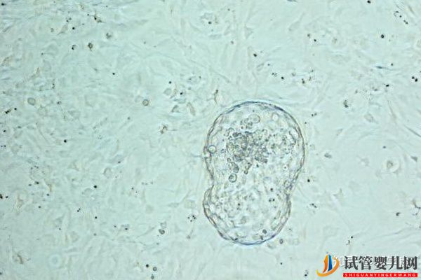 美国试管婴儿技术正解-常见的4个问题解读(图3)