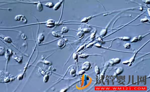 关于男性少精弱精那些事(图1) 关于男性少精弱精那些事(图1)