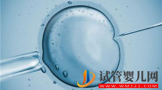 俄罗斯试管婴儿攻略 看看有哪些你不知道的(图4) 俄罗斯试管婴儿攻略 看看有哪些你不知道的(图4)