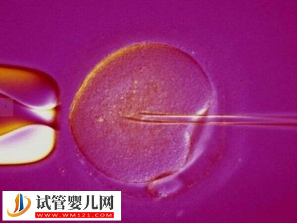 反复生化是什么原因导致的(图1) 反复生化是什么原因导致的(图1)