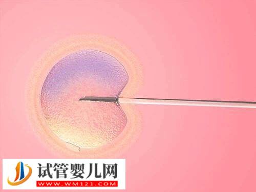 子宫内膜异位症要不要做试管(图1) 子宫内膜异位症要不要做试管(图1)