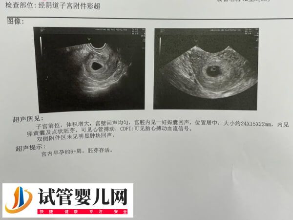 内膜移植窗口期一共查几次(图1) 内膜移植窗口期一共查几次(图1)