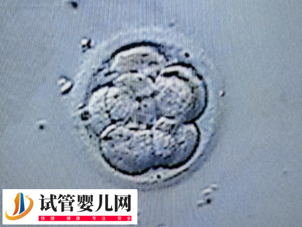 移植失败后能不能锻炼(图2) 移植失败后能不能锻炼(图2)