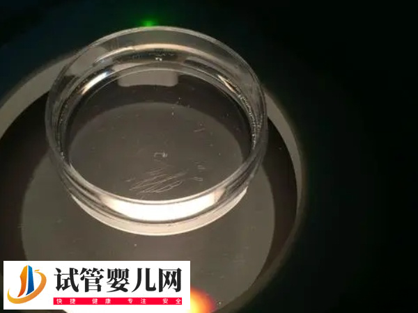飞机杯取精做试管婴儿有危险不(图1)