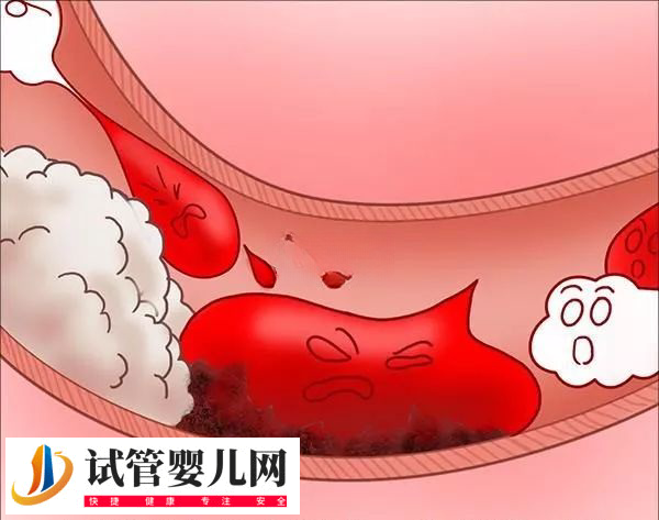 移植前后吃麻油有无影响(图1)