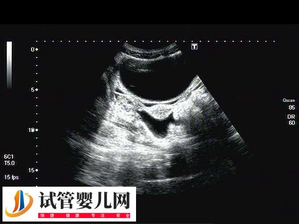 移植前后吃麻油有无影响(图2)