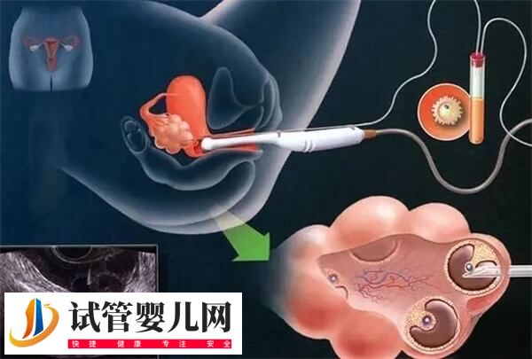 取卵后有淤血块流出正不正常