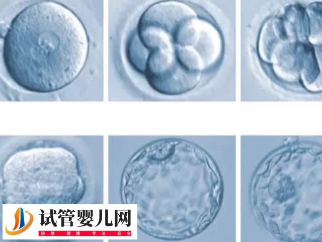 囊胚移植有什么优点(图1)