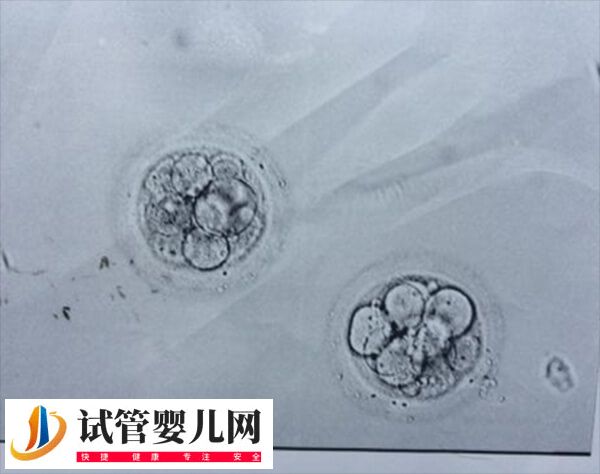 4bc囊胚移植成功率高不高(图2)