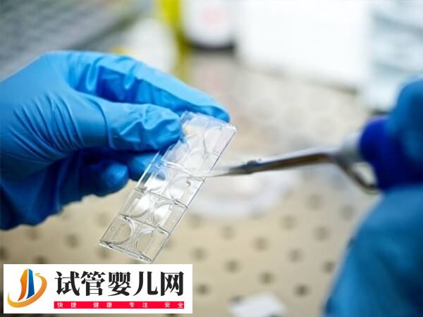 自然周期囊胚移植流程是怎样的(图1)