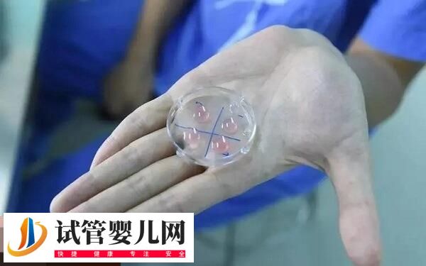 一文了解PPOS方案,适用于什么人、具体流程怎样速看(图2) 一文了解PPOS方案,适用于什么人、具体流程怎样速看(图2)