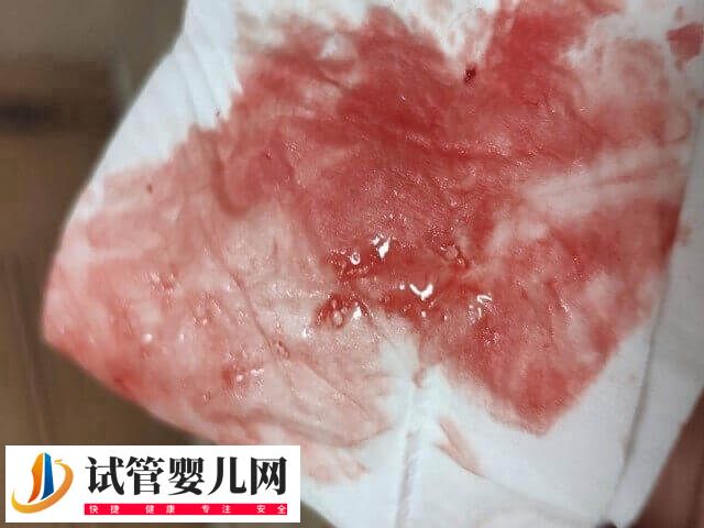 囊胚移植失败有什么症状(图1)