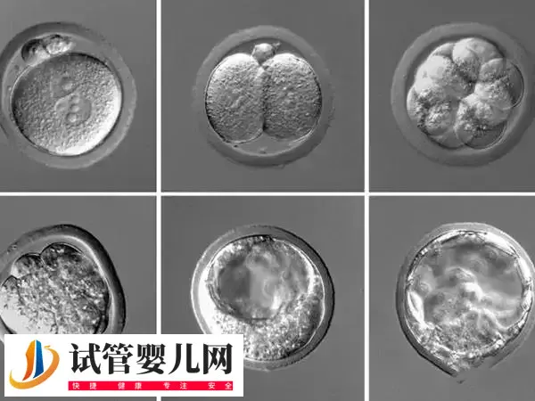 囊胚移植失败有什么症状(图2)