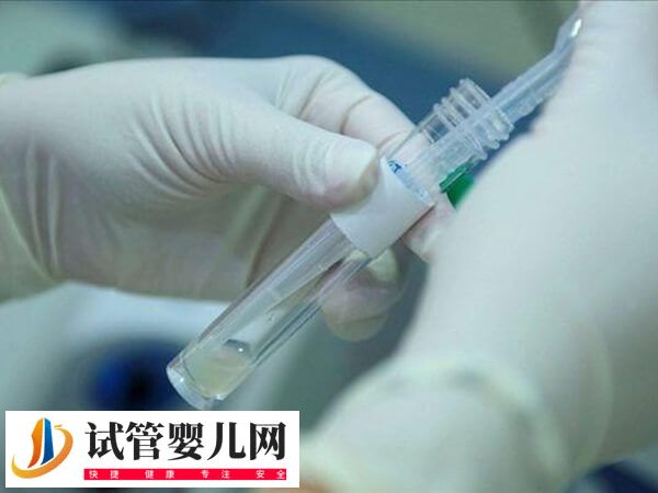 试管取卵前排精注意什么事项(图2)