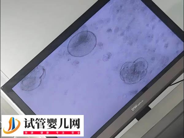 没达到冷冻标准的囊胚能否移植(图1) 没达到冷冻标准的囊胚能否移植(图1)