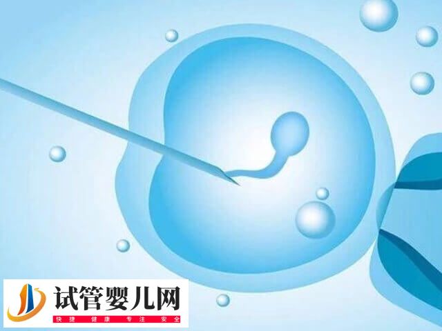 微刺激方案促排取卵有哪几步(图1)