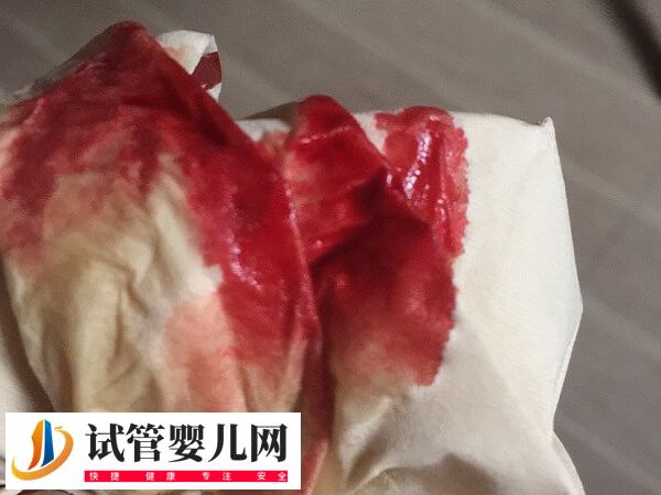 试管移植失败后有什么症状(图1)