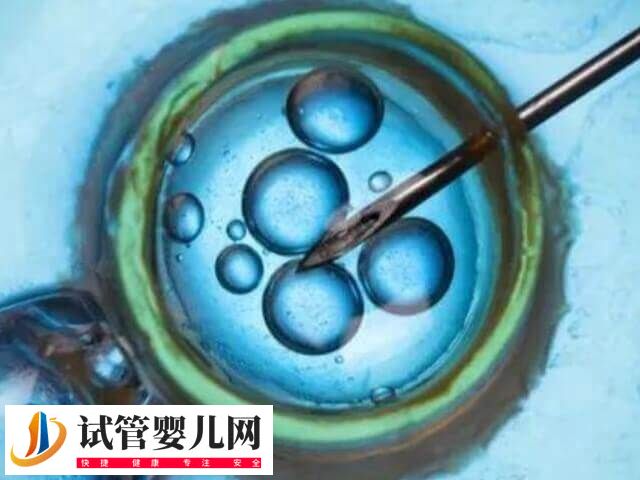 取卵对人体的伤害大不大(图1)