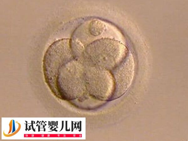 试管婴儿移植前胚胎如何评分(图1)