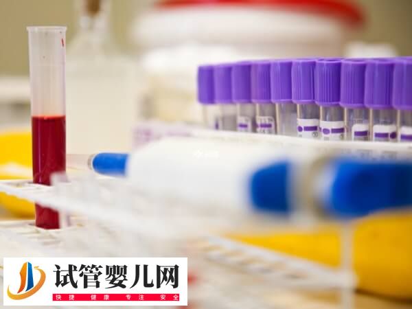 两次查的amh值为什么不一样(图2) 两次查的amh值为什么不一样(图2)