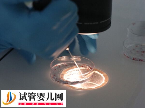 3代试管婴儿能否排除唇腭裂(图2)