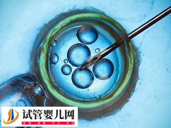 谨慎移植的成功率有多少