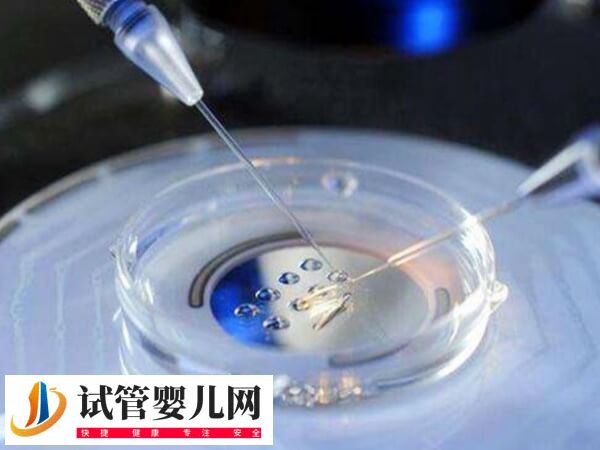 三代试管婴儿能不能筛查鱼鳞病