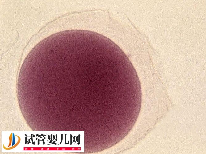 胚胎辅助孵化技术安不安全(图1)