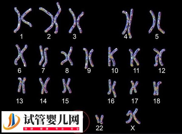 22号染色体异常会有哪些遗传病(图2) 22号染色体异常会有哪些遗传病(图2)