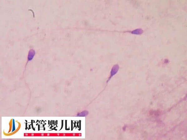 女性骨髓造精多少钱(图1) 女性骨髓造精多少钱(图1)