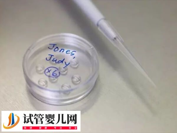 三代试管婴儿患唐氏几率高不高(图3)