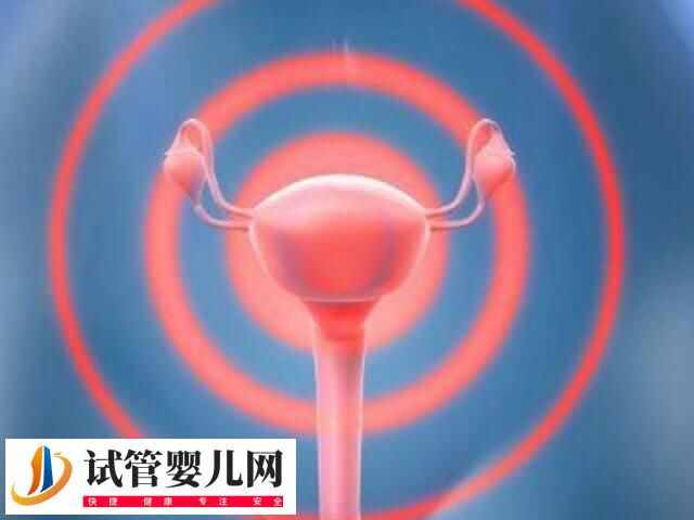 子宫切除手术有哪5种(图3) 子宫切除手术有哪5种(图3)