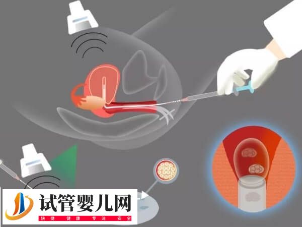 试管移植第四天出血是怎么回事(图1)