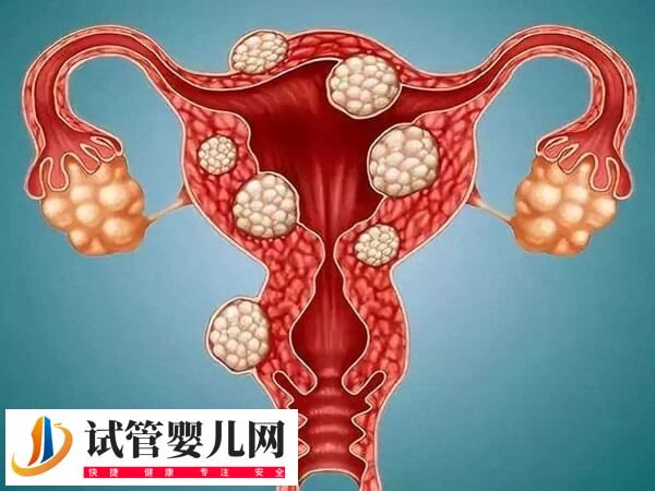 子宫切除手术危害大不大(图1) 子宫切除手术危害大不大(图1)