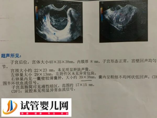 子宫切除手术危害大不大(图2) 子宫切除手术危害大不大(图2)