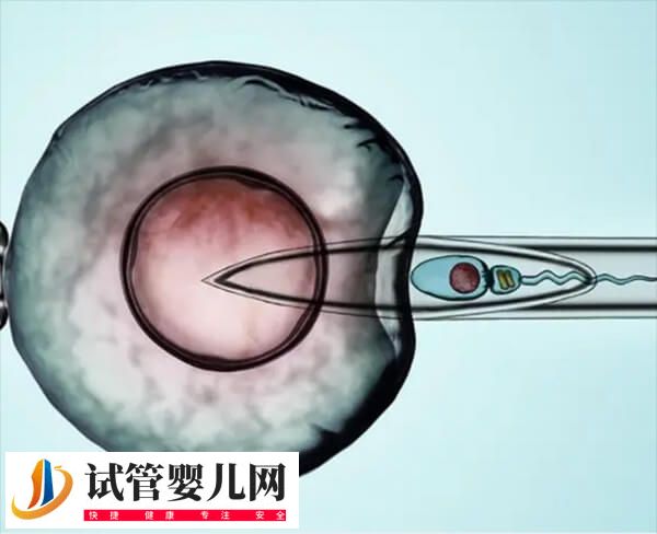 试管移植需不需要扩开宫颈(图2)