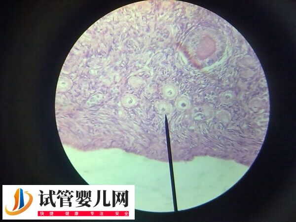 普丽康为什么加尿促(图2)