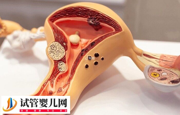 宫腔粘连在南宁做试管需要多少钱(图1)