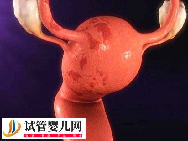 子宫内膜容受性什么意思(图1) 子宫内膜容受性什么意思(图1)