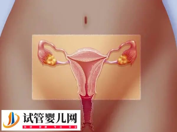 卵泡破裂会不会肚子疼(图4) 卵泡破裂会不会肚子疼(图4)