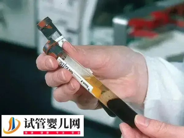amh0.27做试管婴儿成功率多少(图1) amh0.27做试管婴儿成功率多少(图1)