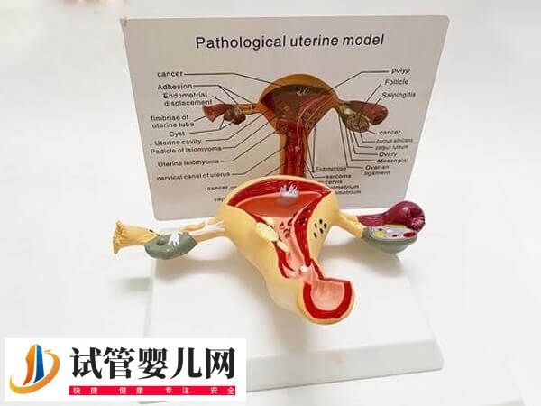 子宫畸形的有哪些(图1)