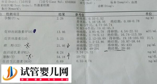 fsh促卵泡素高于20能不能做试管(图1)
