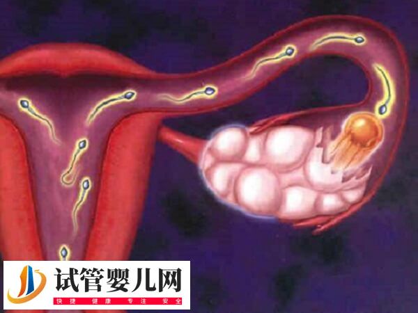 输卵管不孕能不能做试管婴儿(图1)