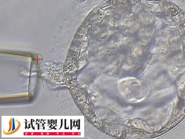 隔了3天卵泡才长了1mm正不正常(图2) 隔了3天卵泡才长了1mm正不正常(图2)