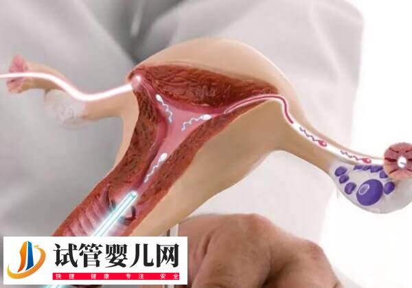 第四代试管婴儿适不适合大龄女性(图2)