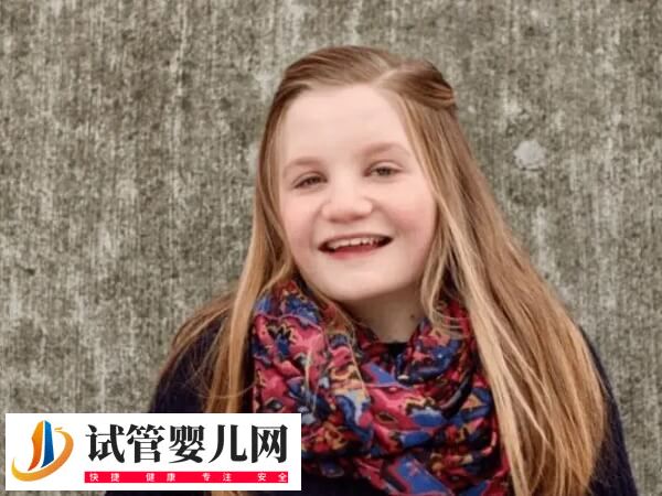 特纳氏综合症女孩图片(图1)